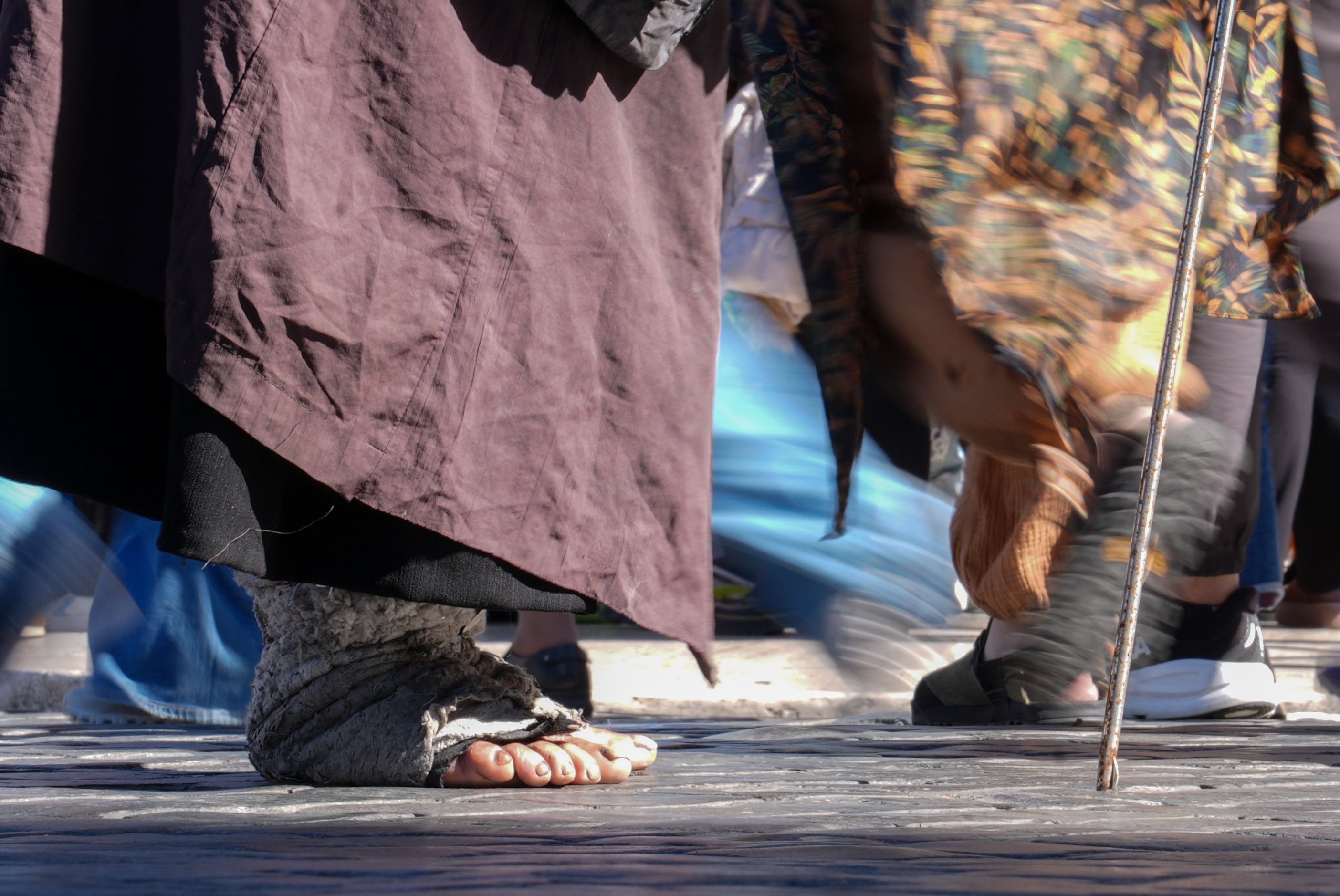 A person with wrapped feet asks for alms